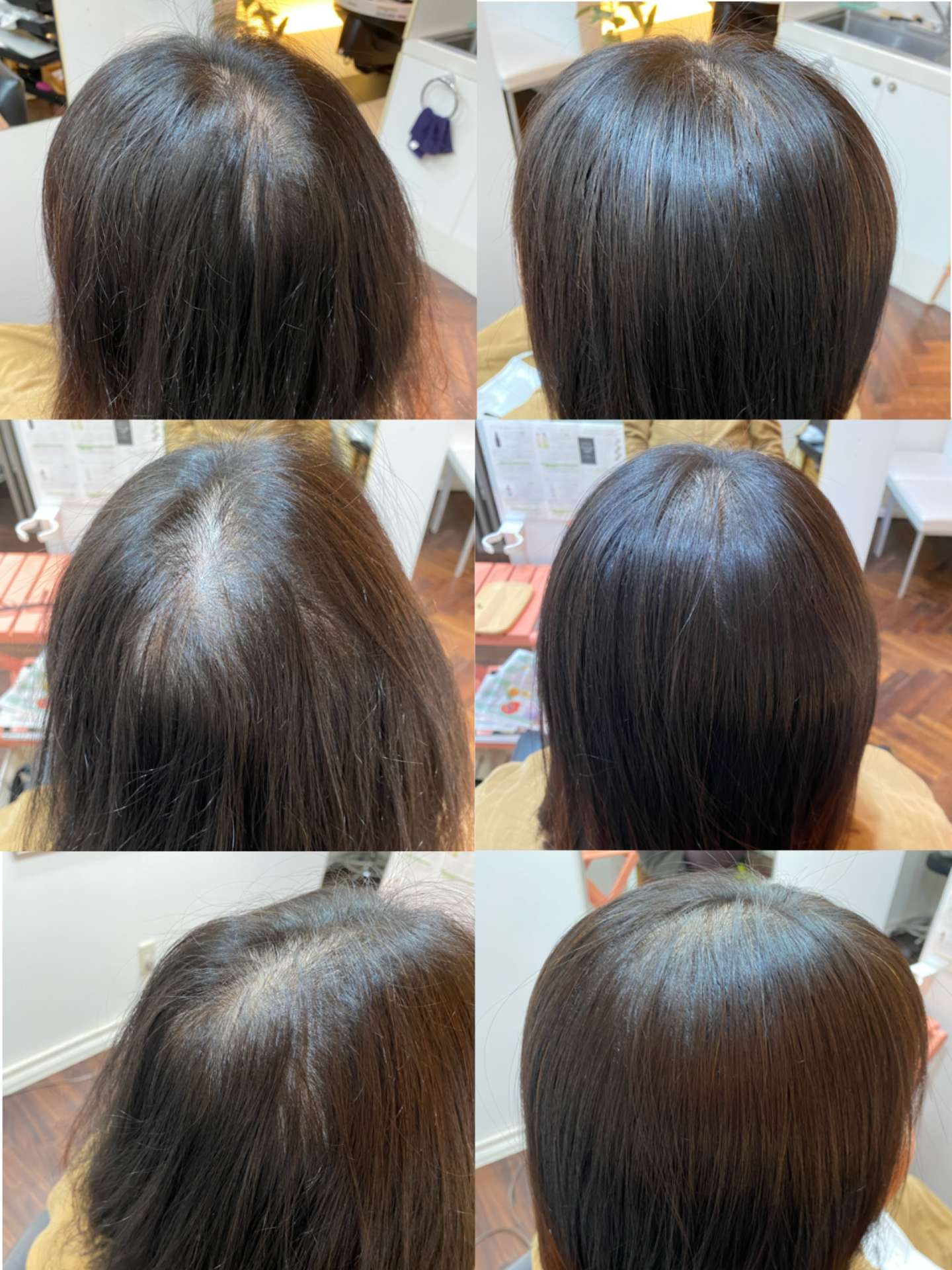 福井で髪の薄毛改善、育毛についてお悩みなら増毛エクステ専門店ふわりです。〜施術実例〜
