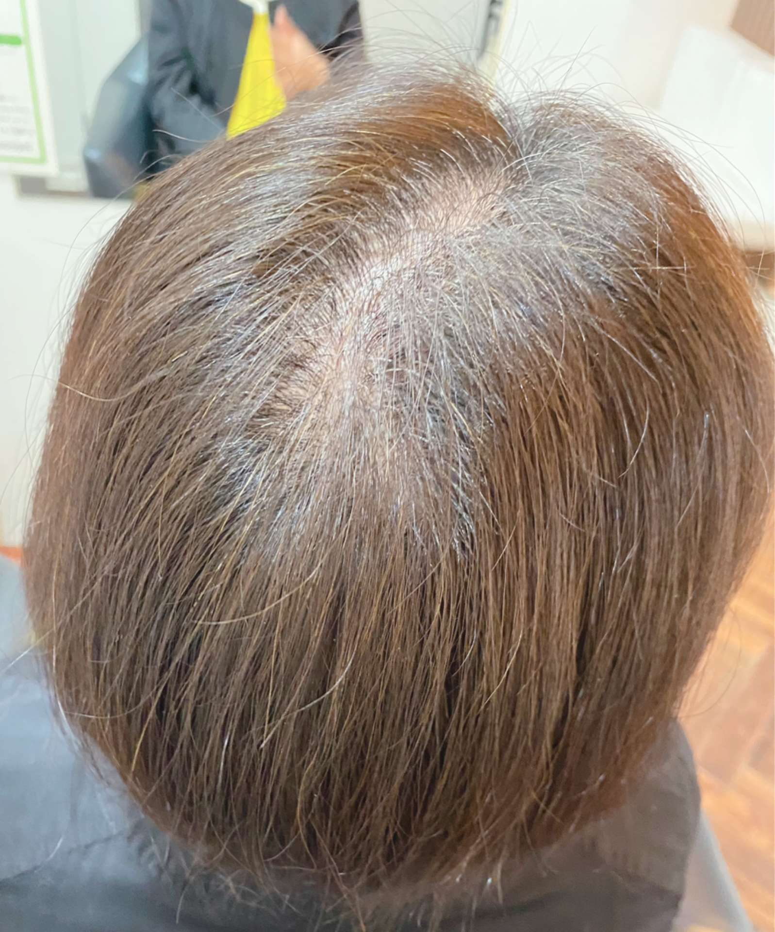 ふわりの増毛エクステ施術実例です。【福井で増毛、薄毛対策、薄毛改善なら「ふわり」】